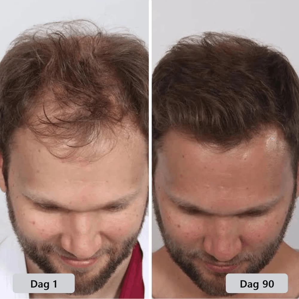 Klantresultaat: dag 1 en dag 90