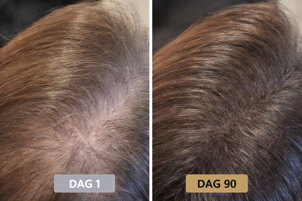 Klantresultaat: dag 1 en dag 90