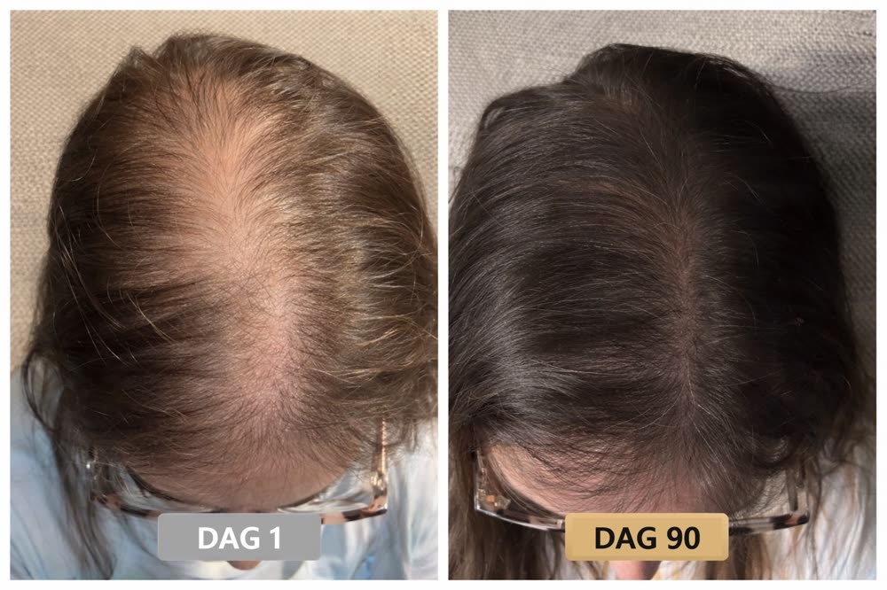 Klantresultaat: dag 1 en dag 90